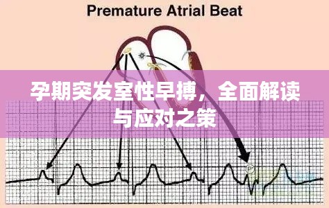 孕期突发室性早搏，全面解读与应对之策