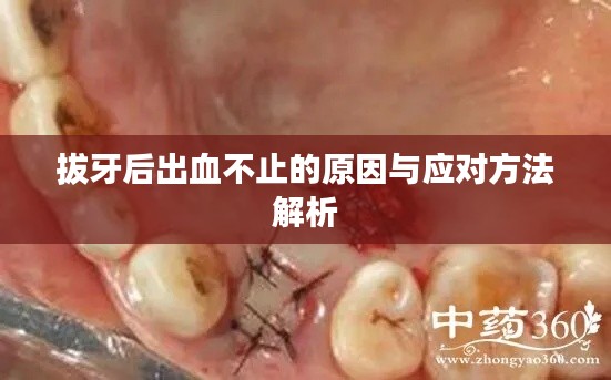 拔牙后出血不止的原因与应对方法解析