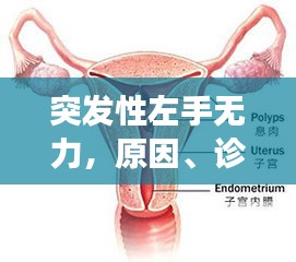 突发性左手无力，原因、诊断及有效治疗方法全解析