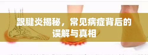 跟腱炎揭秘，常见病症背后的误解与真相